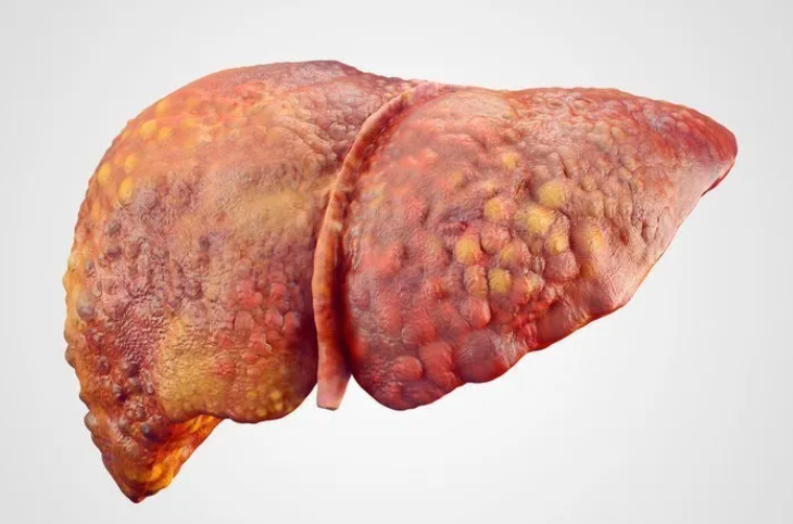 Liver Cancer Banner