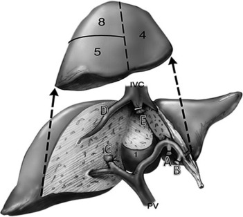 Liver Resection & Liver Transplant Support